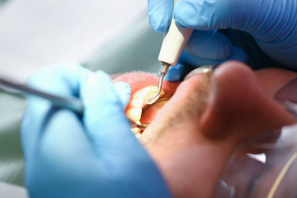 Best Emergency Dentist for Special Needs Patients in Knoxvle, IL